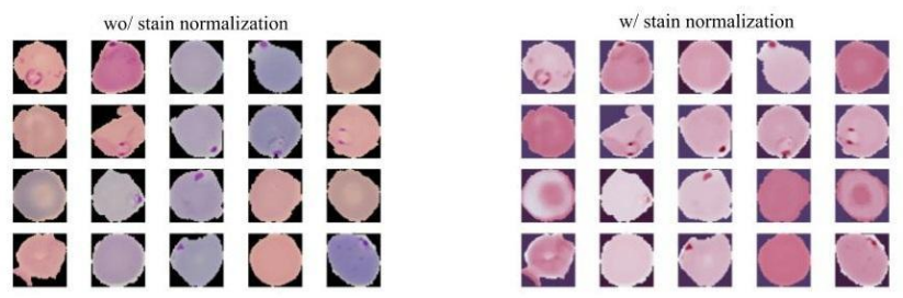 Figure 04
