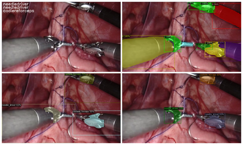 Figure 11