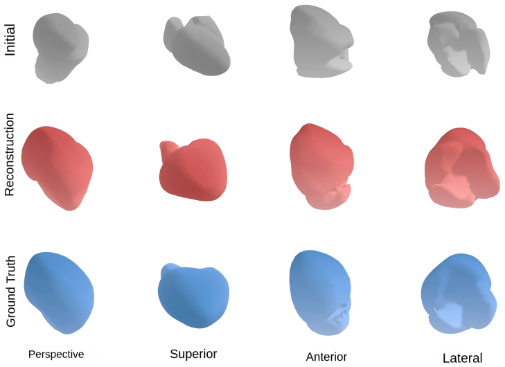 Figure 11