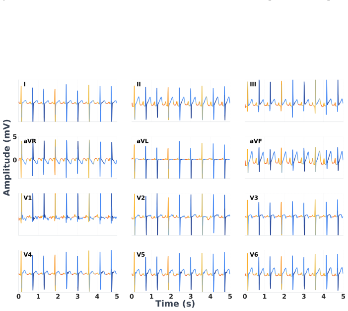 Figure 14
