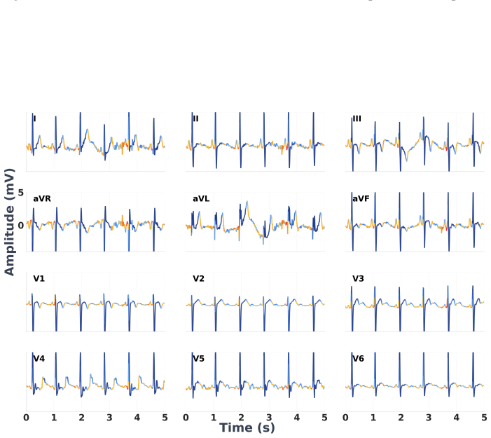 Figure 16