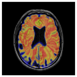 Figure 12