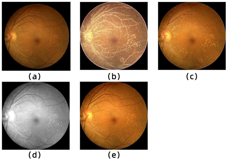 Figure 12